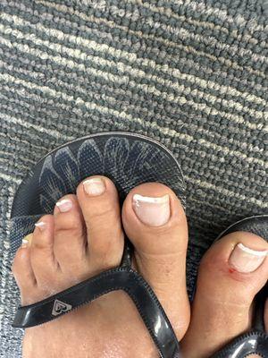 Chipped toe nail polish