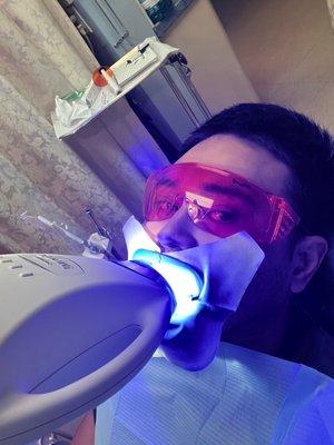 Zoom Whitening