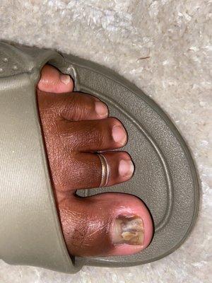 Pay attention to the other toes, why is one toenail long and square/round and the rest are uneven and rounded.