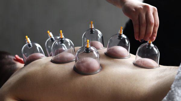 Cupping and IASTM treatment to improve healing time