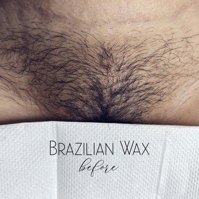 Brazilian Wax-before