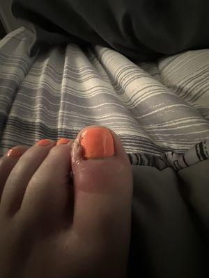 Big toe infected.