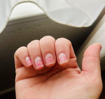 Natural nails drilled down to the nail bed when they used the wrong drill bit to remove my gel polish. This is after three weeks of healing.