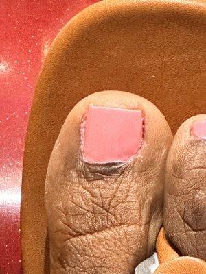 Awful Pedicure.