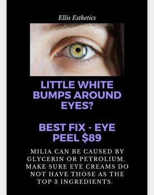 Eye peels are more effective than any eye cream on the market!