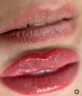 Lip blush