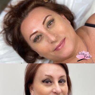 Before and After Brow Transformation