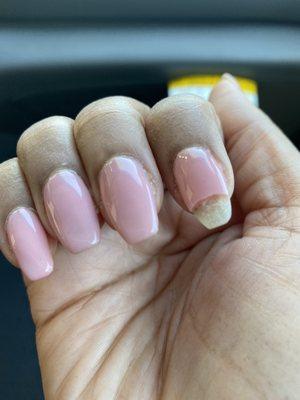 Broken nail