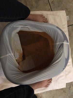 Ionic foot bath. I was highly acidic - tons of metals on the last day of my 5 day sugar detox.