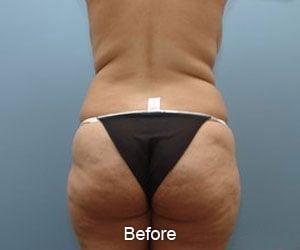 PRE I LIPO ULTRA PLUS