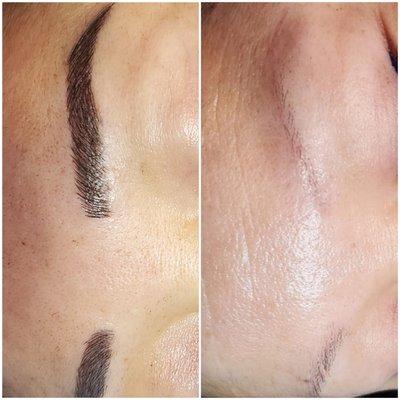 Microblading