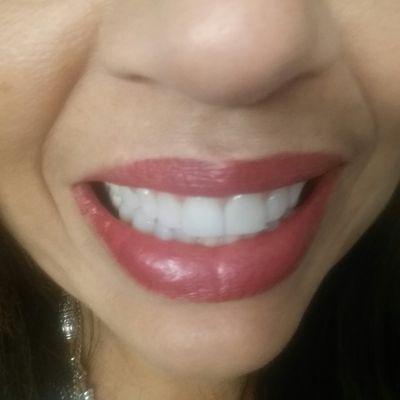 My perfect smile, thanks to Dr. Sherri Bluth!