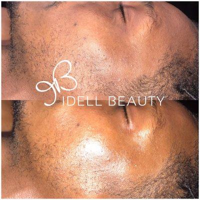 Idell Beauty SIGNATURE Facial