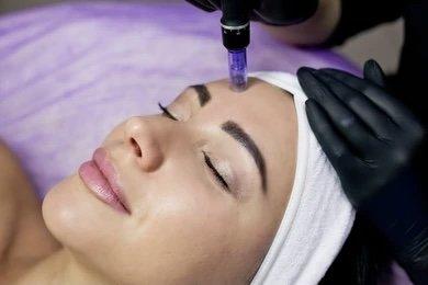 Microneedling City Detox Facial