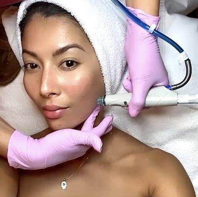 Hydrafacial