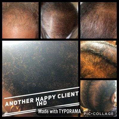 Scalp Therapy Program