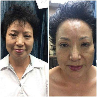 Before and after facial massage treatment