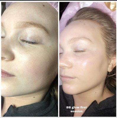 BB Glow ( natural and subtle way to get the perfect skin tone with out need of makeup ) 275