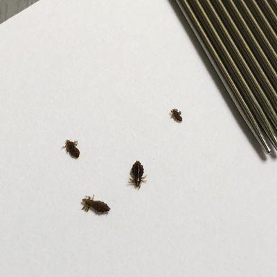 you can see how small lice are compared to comb