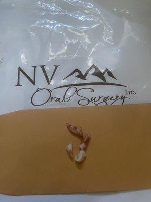 NV Oral Surgery