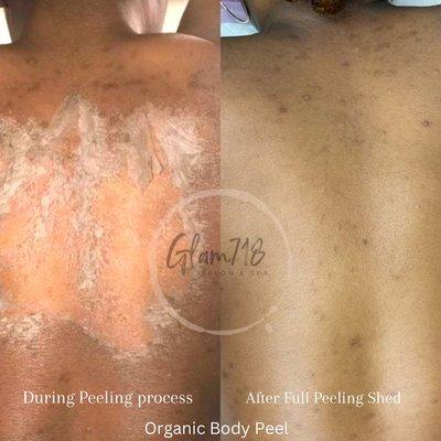 100% Organic body peel , no chemicals . Can be used on any area of the body including intimate, lightning, hyperpigmentation, scars,