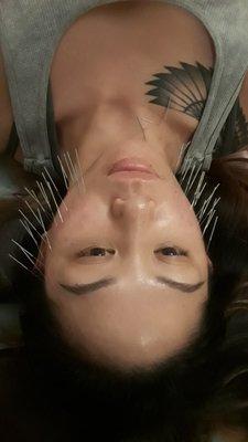 Facial beauty acupuncture Lifting,  facial point,  Wrinkle removal,  white skin, etc