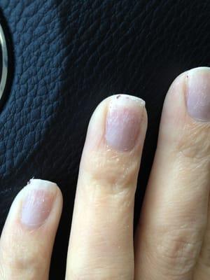 This is what my nails looked like after the shellac removal.