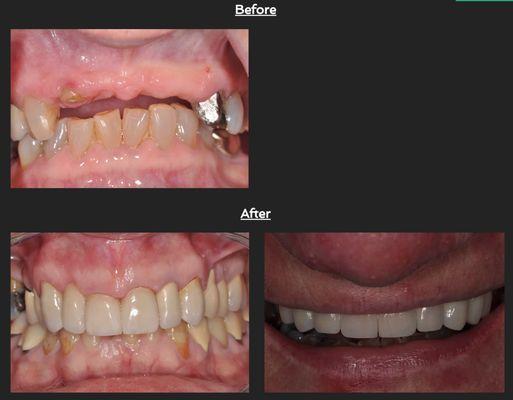 Our Dental Work - Example #3