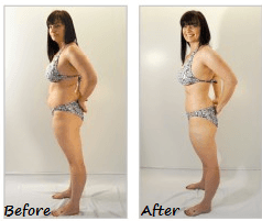 Before & after body treatment