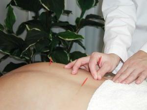 Effective and gentle acupuncture