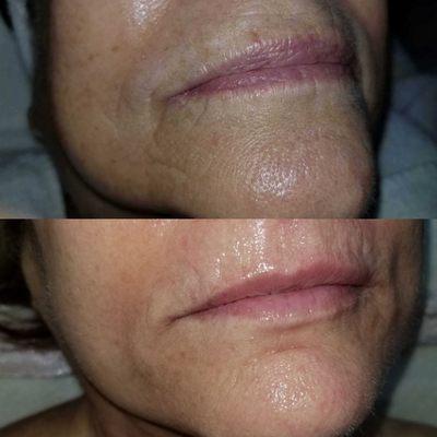 Beauty liquid collegen supplement. No injections needed! It only took 30 days to see these incredible results.