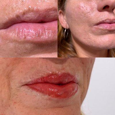 Lip blushing before and after