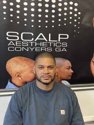 Scalp micro pigmentation at its best