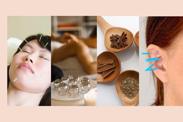 (from left to right) facial acupuncture, cupping, traditional Chinese herbal supplement, ear acupuncture.