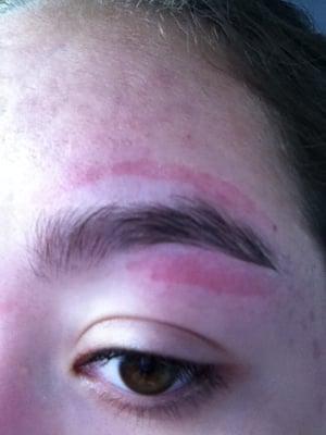 FIRST DEGREE BURN due to an eyebrow waxing done at PLANET NAIL AND SPA.