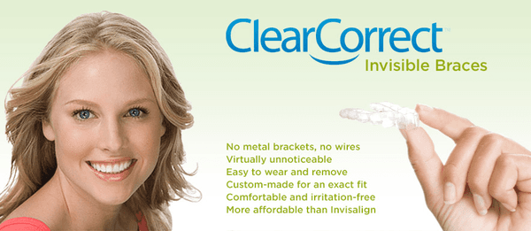 ClearCorrect Invisible Braces