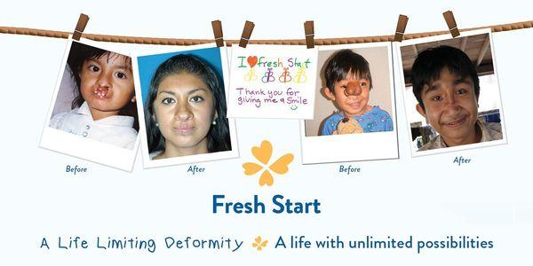 Fresh Start Surgical Gifts