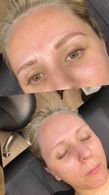 Microblading Before & After