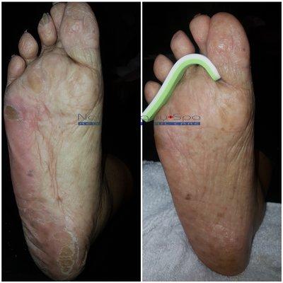 Before and after picture of a client that is bedridden