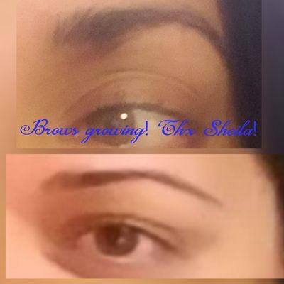 Before and 7 months after Sheila's eyebrow regrowth treatment. A little longer and we shall be done.