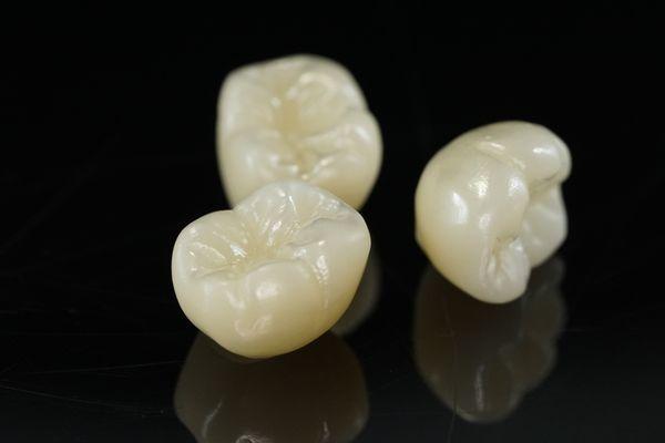 Monolithic Zirconia Crowns