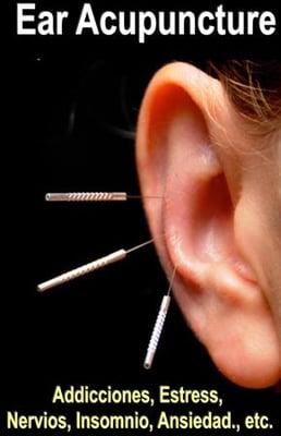 Ear Acupuncture fro Emotional problems: stress, insomnia, nerves, anxiety, addictions such as alcohol,smoking,drugs etc.