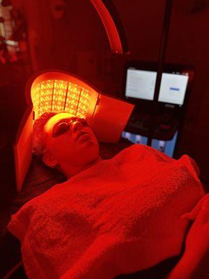 LightStim LED Light Therapy for scalp treatment