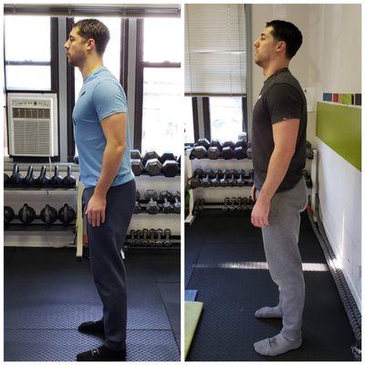 Mobility & Posture Before and After