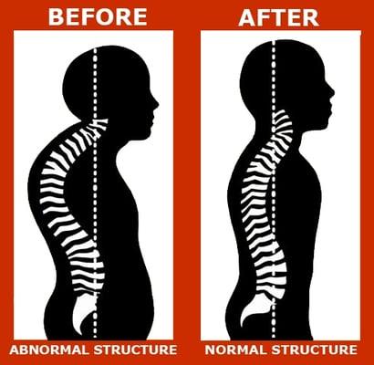 Corrective Chiropractic