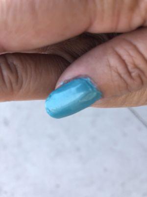 This is a close up of the nail that is  chapped