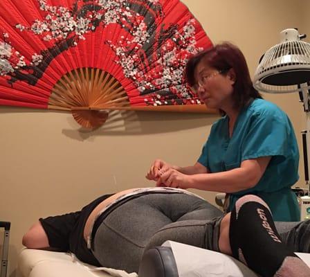 Dr. Li prescribing acupuncture on the lumbar spine.