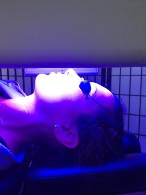 Going after acne causing bacteria. Blue light kills it!!!