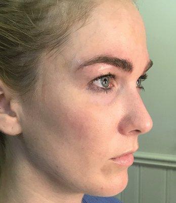 After microblading