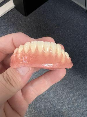 Value denture for a patient of ours with only some of his lower ridge left.